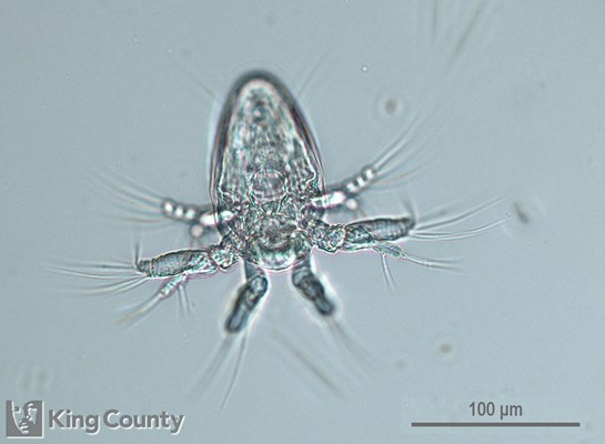 Photo of Copepoda: larval stages